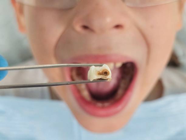 Best Same-Day Emergency Dental Services in Blakely, PA